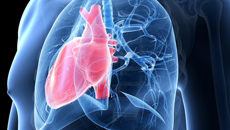 Pulmonary Arterial Hypertension