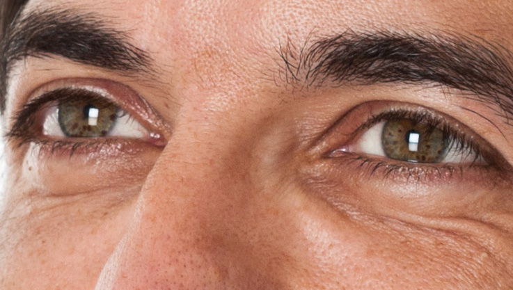 Ways of preventing ED